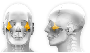 Implants zygomatiques saint jean de vedas